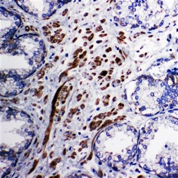 Mitochondrial Pyruvate Dehydrogenase Kinase 1/PDK1 Rabbit Polyclonal Antibody