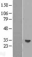 HLA DOB (HLA-DOB) Human Over-expression Lysate