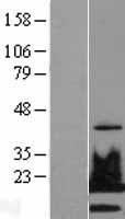 Histone H2A.X (H2AFX) Human Over-expression Lysate