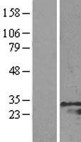 GRB2 Human Over-expression Lysate