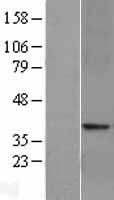 GLP1R Human Over-expression Lysate