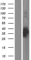 GCLM Human Over-expression Lysate
