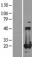 Ferritin Heavy Chain (FTH1) Human Over-expression Lysate