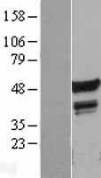 FLI1 Human Over-expression Lysate