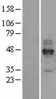 Fc epsilon RI (FCER1A) Human Over-expression Lysate