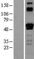 ETV6 Human Over-expression Lysate