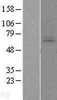 Endothelin A Receptor (EDNRA) Human Over-expression Lysate