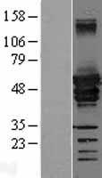 Desmin (DES) Human Over-expression Lysate