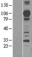 MASP1 Human Over-expression Lysate