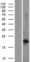 COPT2 (SLC31A2) Human Over-expression Lysate