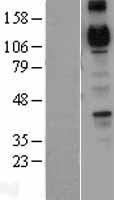 R Cadherin (CDH4) Human Over-expression Lysate