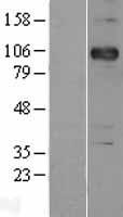 P cadherin (CDH3) Human Over-expression Lysate