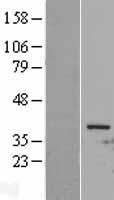 CDK1 Human Over-expression Lysate