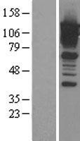 Calpastatin (CAST) Human Over-expression Lysate