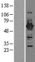 CAMKIV (CAMK4) Human Over-expression Lysate