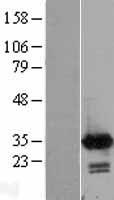 Calretinin (CALB2) Human Over-expression Lysate