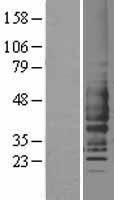 C5R1 (C5AR1) Human Over-expression Lysate