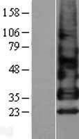 Betacellulin (BTC) Human Over-expression Lysate