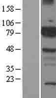 BMX Human Over-expression Lysate