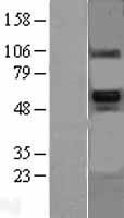 BMP6 Human Over-expression Lysate