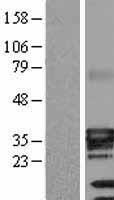 ATP1B3 Human Over-expression Lysate