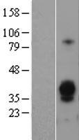Asialoglycoprotein Receptor 1 (ASGR1) Human Over-expression Lysate