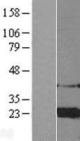 ARF4 Human Over-expression Lysate