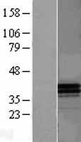 Apolipoprotein F (APOF) Human Over-expression Lysate