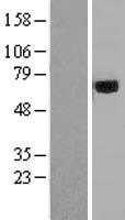Acyloxyacyl Hydrolase (AOAH) Human Over-expression Lysate