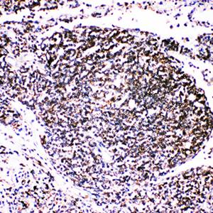 TRAF4 Rabbit Polyclonal Antibody