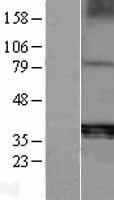Tartrate Resistant Acid Phosphatase (ACP5) Human Over-expression Lysate