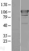 AlaRS (AARS) Human Over-expression Lysate