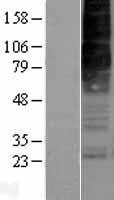 Orexin Receptor 2 (HCRTR2) Human Over-expression Lysate