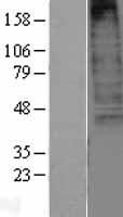 CXCR3 Human Over-expression Lysate