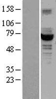 GCKR Human Over-expression Lysate