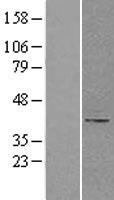 B4GALT1 Human Over-expression Lysate