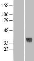 FRZB Human Over-expression Lysate