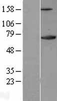 Ku70 (XRCC6) Human Over-expression Lysate