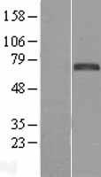 FOXC1 Human Over-expression Lysate