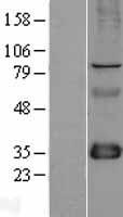 FHL1 Human Over-expression Lysate