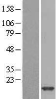liver FABP (FABP1) Human Over-expression Lysate