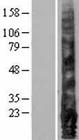 EMP1 Human Over-expression Lysate