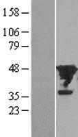 EIF4A1 Human Over-expression Lysate