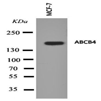 ABCB4 Rabbit Polyclonal Antibody