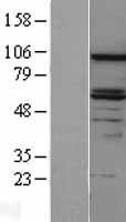 DAB2 Human Over-expression Lysate