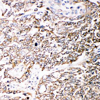 PMP70/ABCD3 Rabbit Polyclonal Antibody