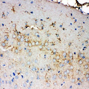 PMP70/ABCD3 Rabbit Polyclonal Antibody