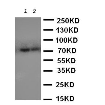 PMP70/ABCD3 Rabbit Polyclonal Antibody