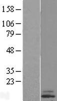 CST6 Human Over-expression Lysate