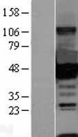 CTBP1 Human Over-expression Lysate